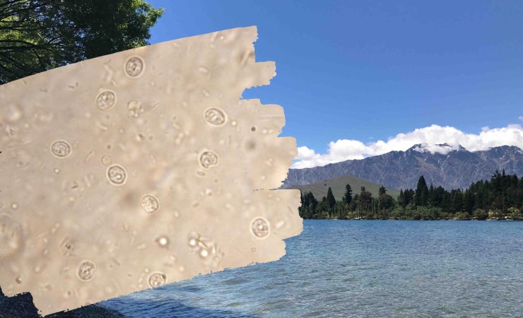 Cryptosporidium and Lake Wakatipu v3