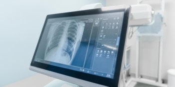 x ray shutterstock 2518394853