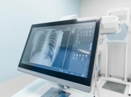 x ray shutterstock 2518394853
